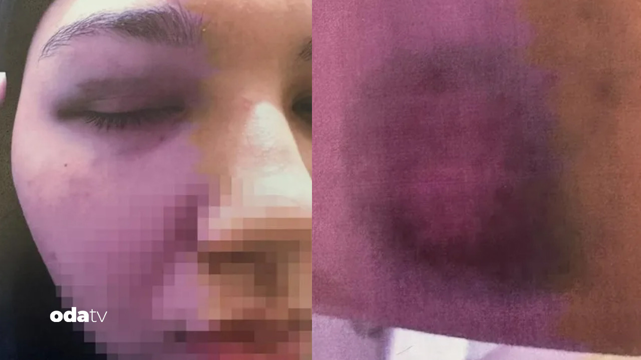 beyoglunda anne kiza bitmeyen siddet hem cinsel hem fiziki rJ2LwcLf