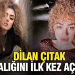Dilan Çıtak, Obsesif Kompulsif Bozukluk ile Mücadele Ettiğini Duyurdu