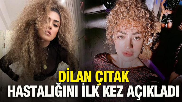 dilan-citak-hastaligini-ilk-kez-acikladi-43eS5EDU