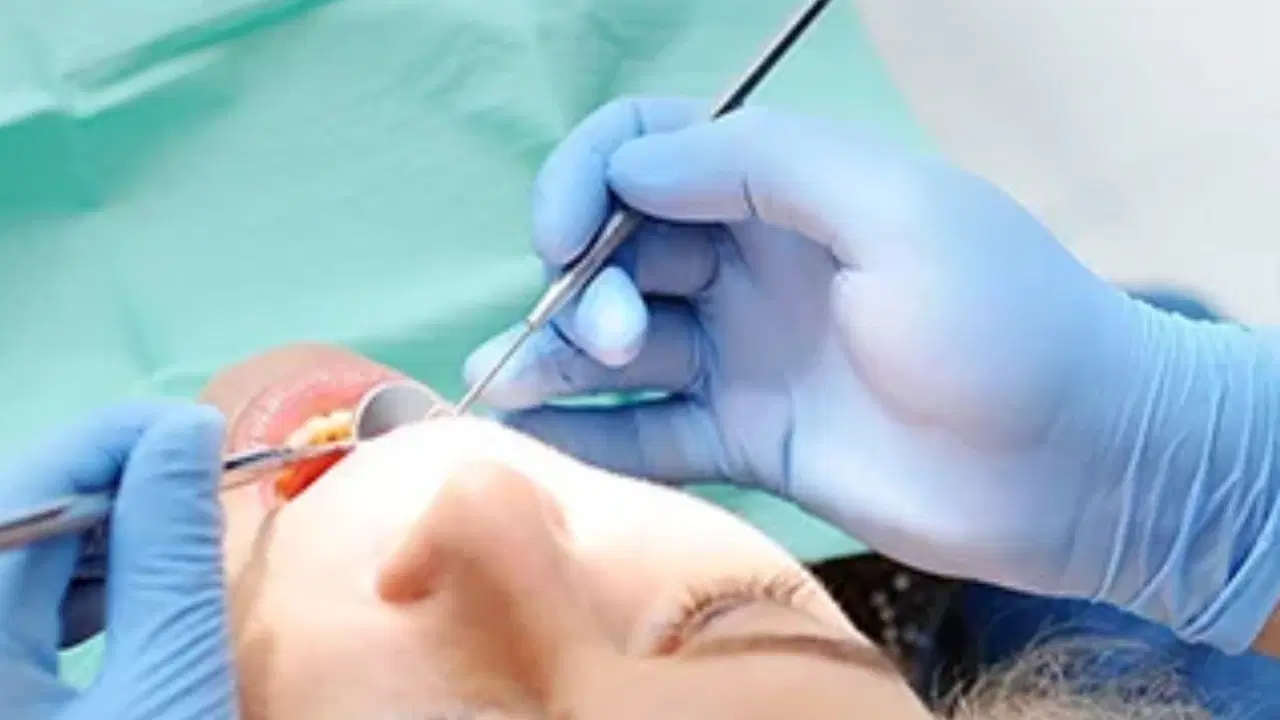 Diş Ağrısıyla Başlayan Kabus: 25 Dişini Kaybetti